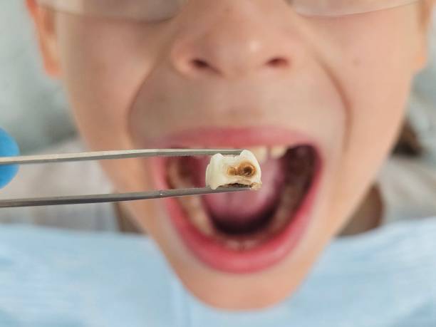 Best Weekend Emergency Dentist in Enosburg Falls, VT